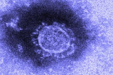 Nhật Bản cô lập thành công virus corona